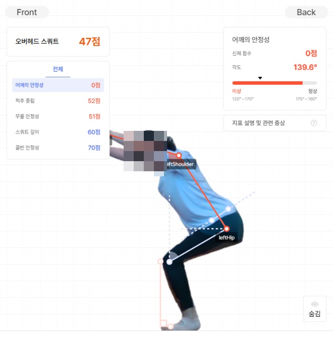 동탄 50대 회전근개 파열 어깨 통증 재활