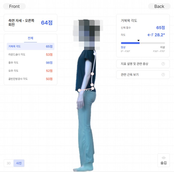 동탄 허리 척추 자세 분석 검사