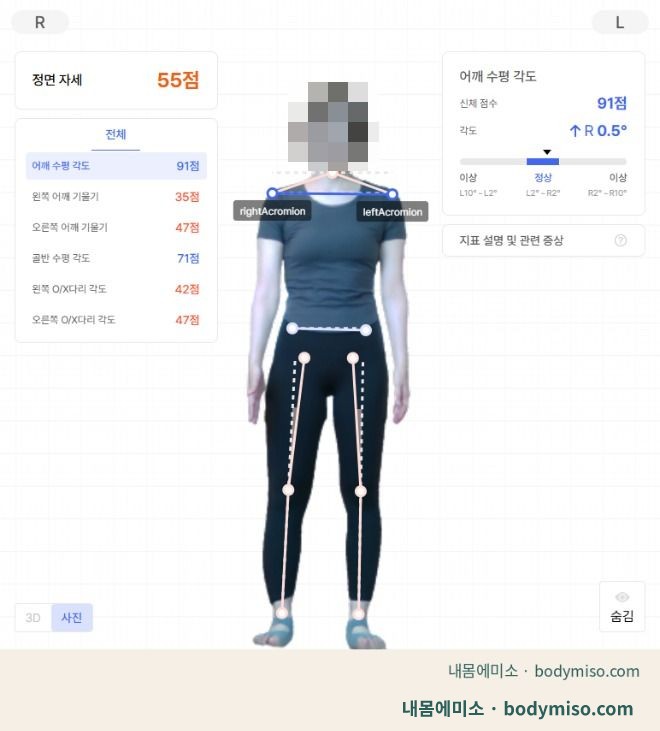정면 체형측정 결과 — 정지 자세 55점, 어깨 수평은 정상 범위 · 내몸에미소