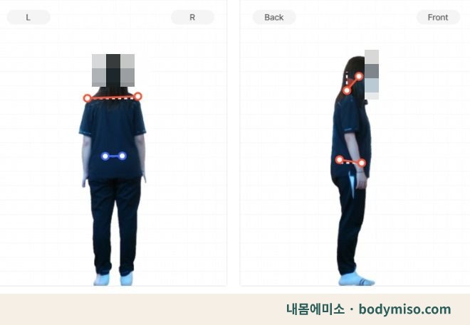 동탄 어깨허리무릎 자세교정 운동