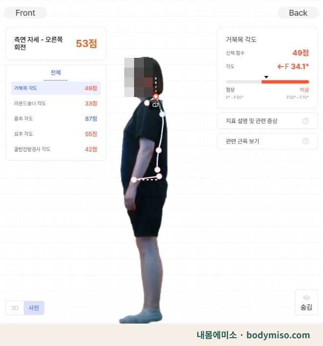 동탄 허리 자세 교정 측정 분석