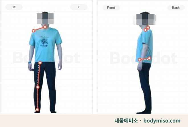 동탄 어깨통증 재활운동 자세