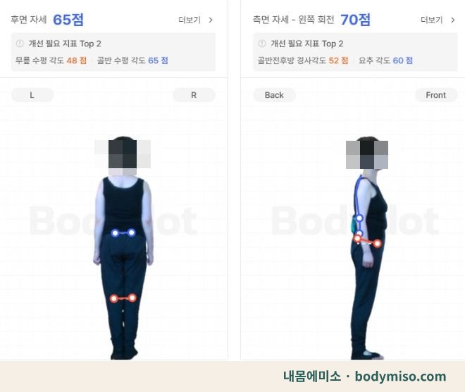 동탄 허리통증 재활운동 자세 분석