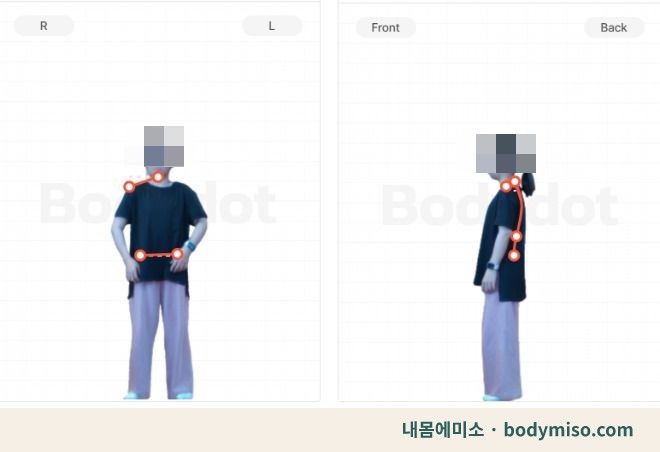 동탄 허리통증 재활운동 자세