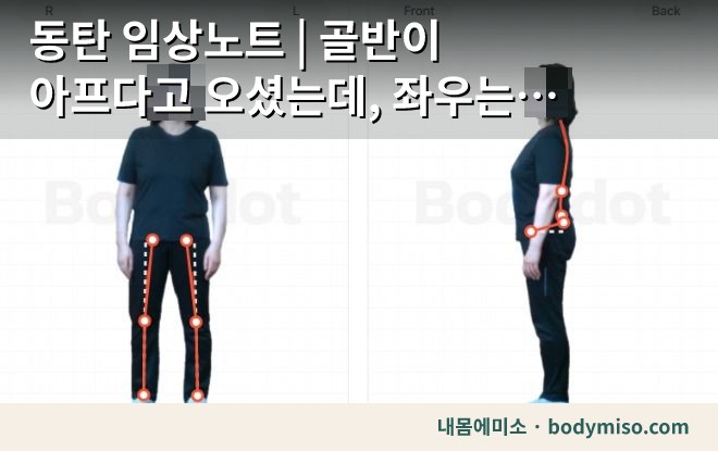 동탄 다리통증 재활운동 자세