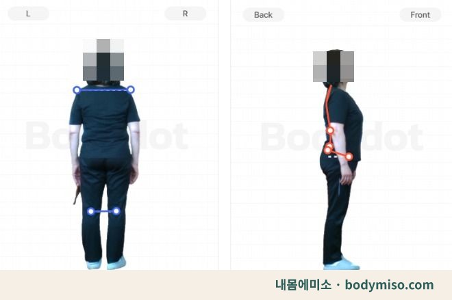 동탄 무릎통증 재활운동 자세