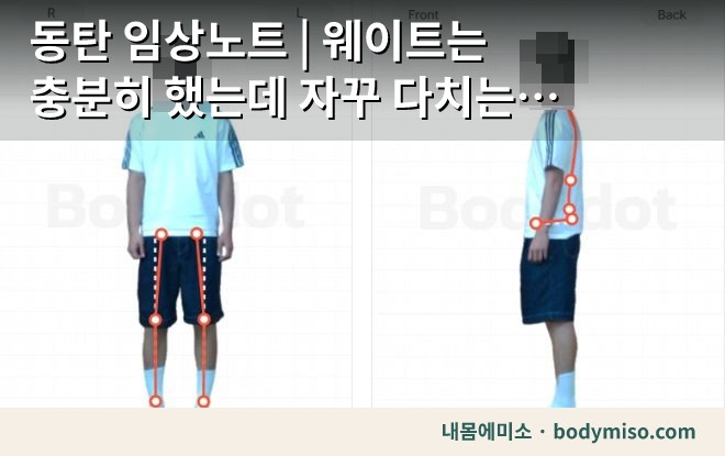 동탄 무릎통증 재활운동 스트레칭