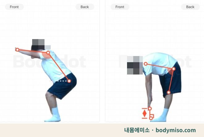 동탄 허리 재활운동 굽혔다펴기 동작