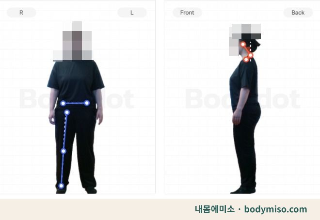 동탄 허리통증 재활운동 자세 교정