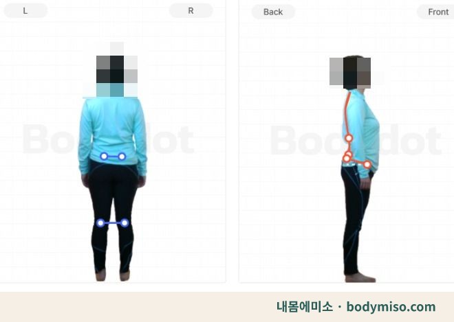 동탄 무릎 허리 재활운동 자세교정