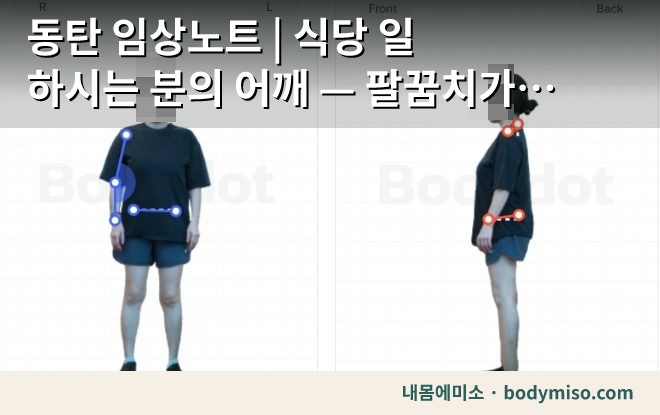 동탄 어깨통증 재활운동 자세