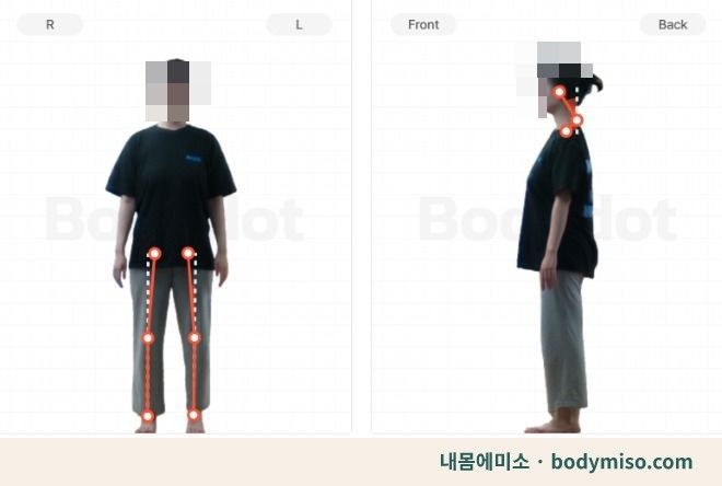 동탄 자세교정 전신 척추정렬 운동