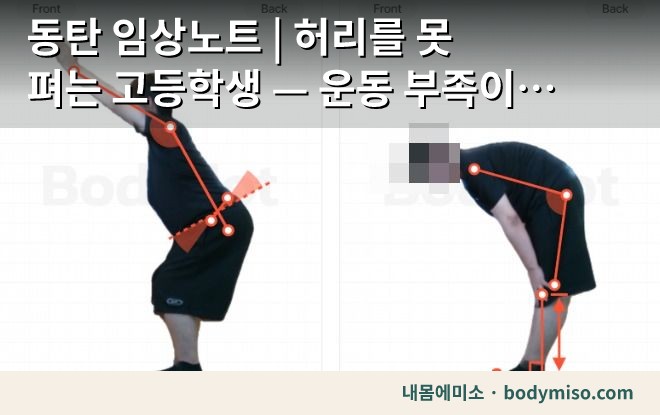 동탄 허리 재활운동 굽히기 자세