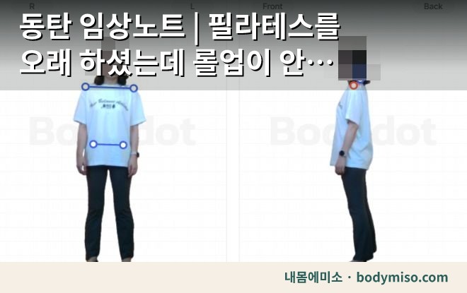 동탄 어깨 자세교정 측정 검사