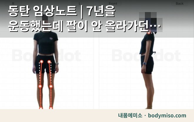 동탄 체형측정 — 정면·측면 결과 화면과 다리 정렬 라인
