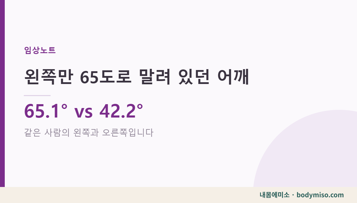 라운드숄더 각도 — 왼쪽만 65도로 말려 있던 30대 남성의 첫 평가