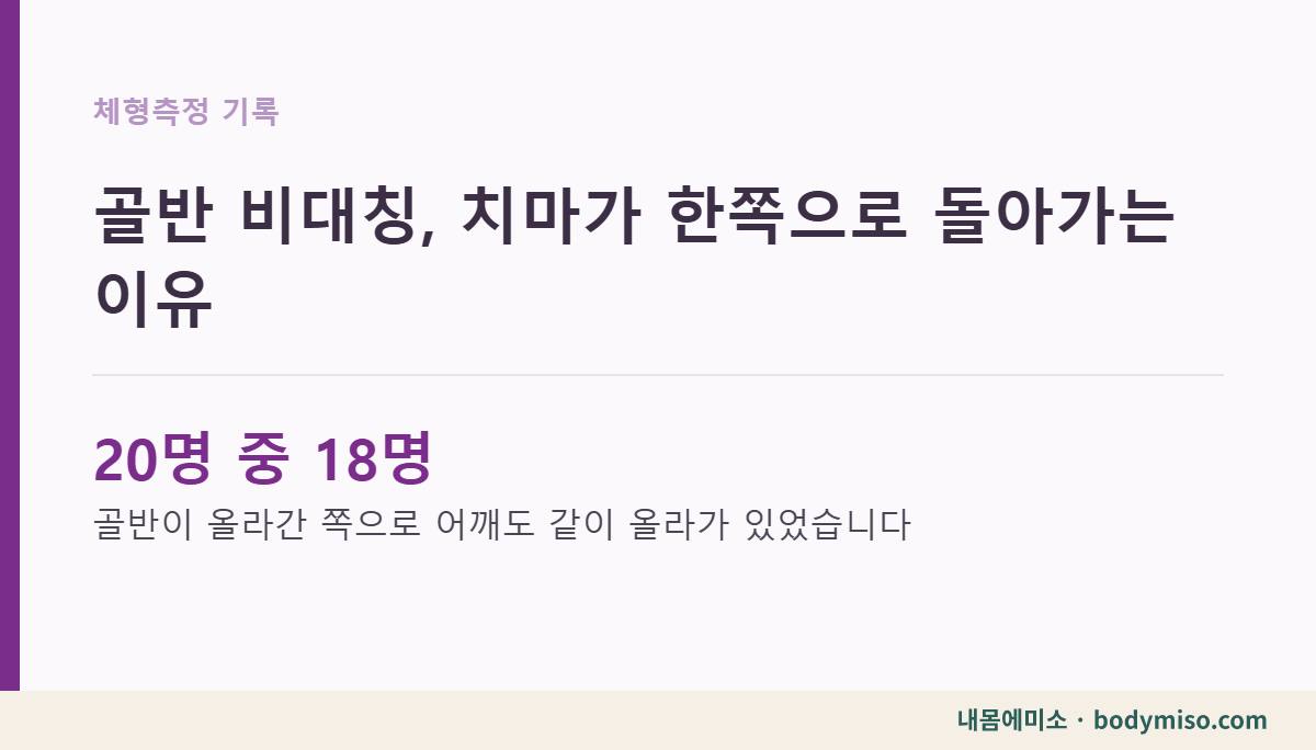 골반 비대칭, 치마가 한쪽으로 돌아가는 이유 내몸에미소