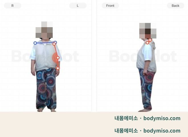 첫 평가에서 촬영한 정면과 측면 체형측정 사진, 어깨와 골반의 좌우 높이를 표시한 분석 화면