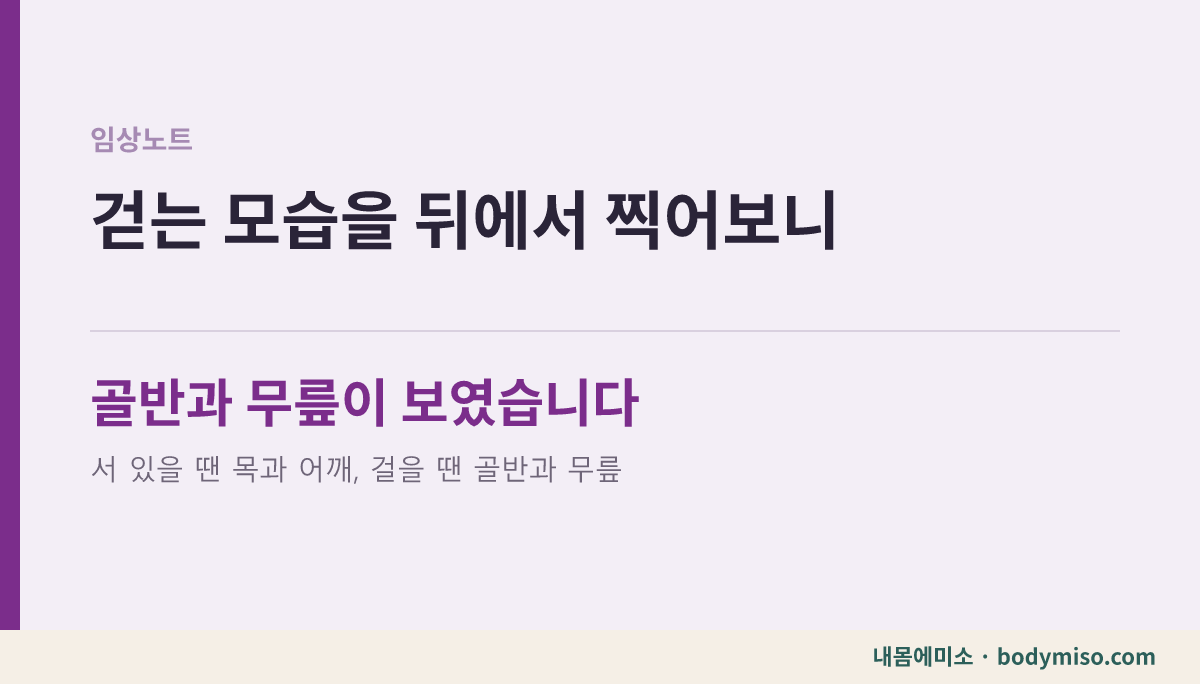트레드밀 보행을 뒤에서 본 20대 회원님 임상노트 카드